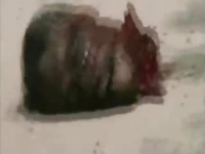 Gruesome Aftermath of Suicide Bombings