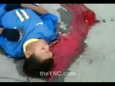 STILL ALIVE Clenching Fists: Poor Kid Shot Has Huge Gaping Hole in his Head but not For Long