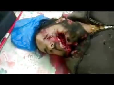 Man Ripped to Shreds Lays Dead Indian Style with his Bones Snapped in Half