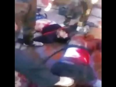 Man with Face Blown Off is Photographed like a trophy by Soldiers