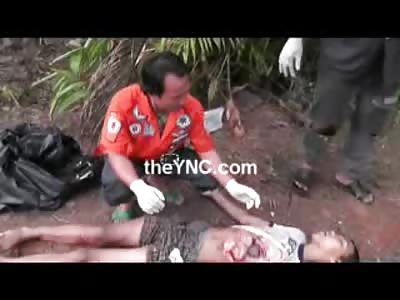 Boy hit by a Bus has most of his Organs Sitting on his Stomach 