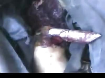 The Horrific Remains of men Tortured Beyond Belief Eyes Burned Out an Much Worse