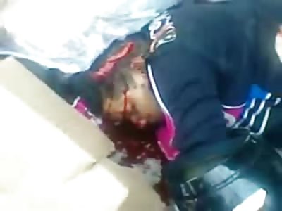 Brains Leaking out from Horrible Motorcycle Accident