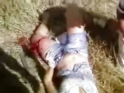 Pretty Girl with Huge Gash on her Leg Thinking How Lucky That She Isn't Her Homegirl with her Leg  Ripped off