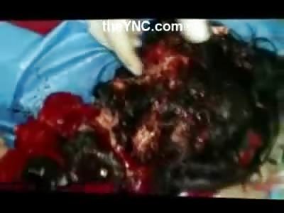 Just a Head? Girl with Fresh Brains Exposed and looks to be Decapitated