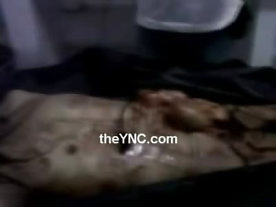 Bizarre Male/Female with Gag around Mouth was Gutted is looked at in Dark Room