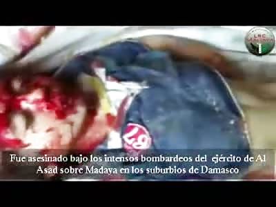 Poor Little Kid Killed Head Cracked and Brains Exposed