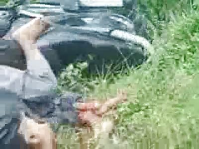 Is that his Leg Bone? Pretzel Man Filmed after Accident