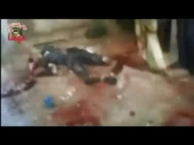 Well There's Head Trauma and then There's This