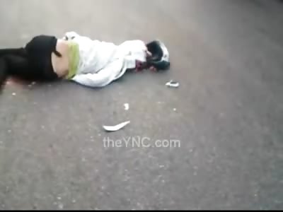 Woman in Tight Black Pants and Her Brain Separated From Accident