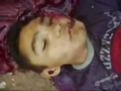 Boy on Minibike Killed hitting Concrete Divider 