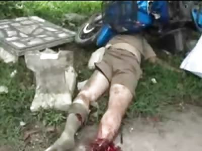 Man Loses 1 Arm and 1 Let....Eventually his Life