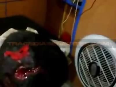 Shot in the Back of the Head Still Alive Like a Boss