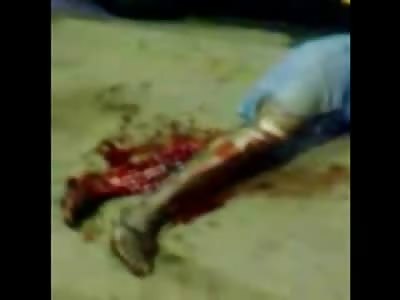 Woman in Jean Skirt Squirms on the Road with her Leg Skinned to the Bone