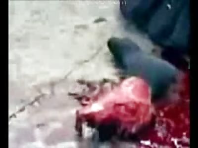 Calm guy Just Chilling Next to His Severed Leg