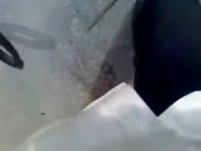 What your Head really looks Like after being Popped by a Truck...Close Up 