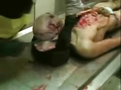 New Video shows a Man in the Morgue being Cut Open followed by showing his Full Stomach from the Inside (Watch till End for Stomach)