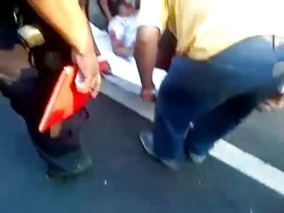 Woman in Black Bra and Miniskirt has Her Leg Ripped To Shreds