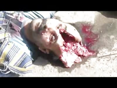 Brains Leaking Flies Eating inside of Mans Skull