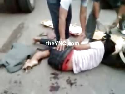 In Pain and Shock....Foot Flattened when Ran over by a Car