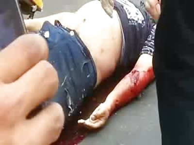 Biker broke every Bone in his Body is Loaded Away 