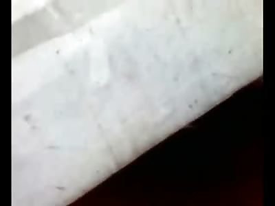 Elderly Woman Attempted Suicide still Alive but lost her Legs 