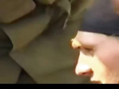 TERMINATOR... Rebel Has Bullet Removed from his Head with Pliers