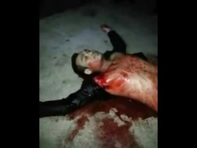 Man Shot in the Neck losing Blood way too Fast (watch at :49 Blood Pumping out of Neck as Heart Beats) 