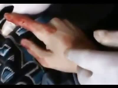 Man Shot in the Head Still Alive Gasping for Life