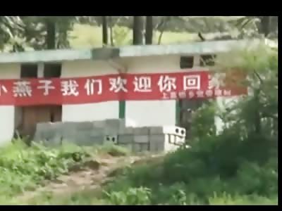 VERY SAD: Poor Little Girl has Disgusting Tumor Growth on her Left Eye