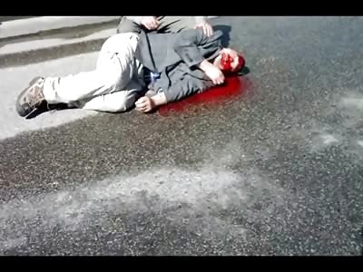 Suicidal Man Left Bloody and Gasping after he Jumped from a Walkway in Calgary