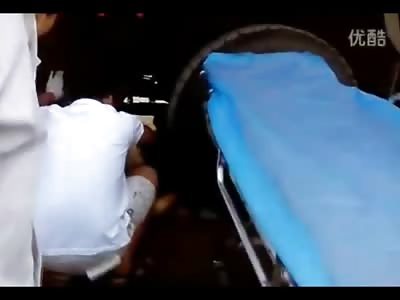 OUCH!! Woman's Legs Crushed under Trucks Massive Wheel