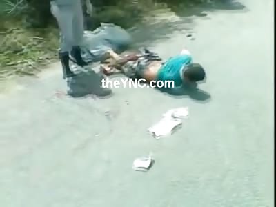 Twisted and Mangled Frozen after Accident.....is he Dead or Alive?