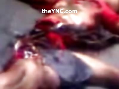 Man is Ripped in Two Pieces from Brutal Accident