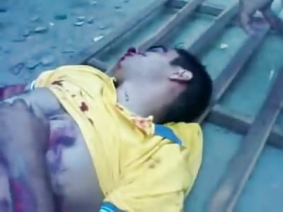 Boy who Jumped from a Rooftop and Landed on a Fence Breaks both Legs and Dies in the Hospital (Still Alive on Video)