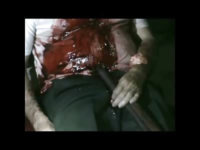 Old Man Shotgun Suicide right outside his Front Door has his Brains on his Forearm