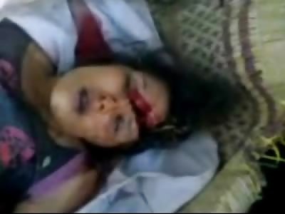 Short Video of Woman with a HACKED head and Bugs Crawling on Her