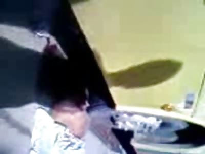 Older Mans Leg Crushed under Bus ... Still Alive in Agony