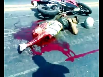 Biker in Shock Lost his Leg in Horrific Crash