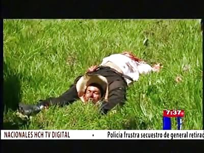 Smiling Man is Beheaded and has his Head Placed Between His Legs