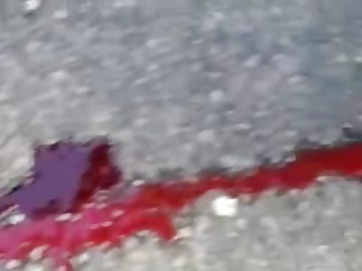 Man lying on Thick Pile of his Brains after Crushed to Death by Bus 