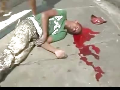 Man Still Alive after Being Shot in the Head Twice During a Protest......Later Dies in Hospital