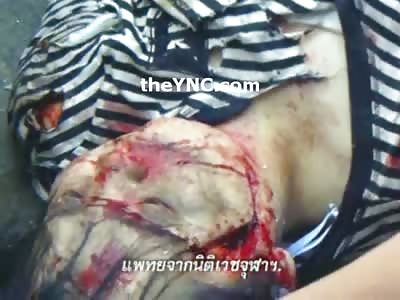 Skinny Girl Has her Head Cracked Open