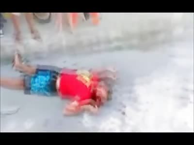 Dude Shot in the Face Bleeds out in Agony on the Sidewalk