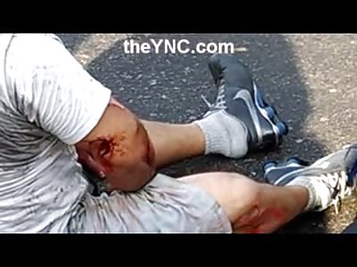 Frustrated Robbers: Two Thieves Shot by Police One in Pure Agony