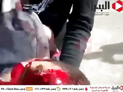 Kid Shot and has his Forehead Removed During Protest (2 Different Camera Angles)