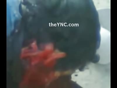 Young Boy shot in the Neck Bleeding Profusely and Dying in his Final Moments