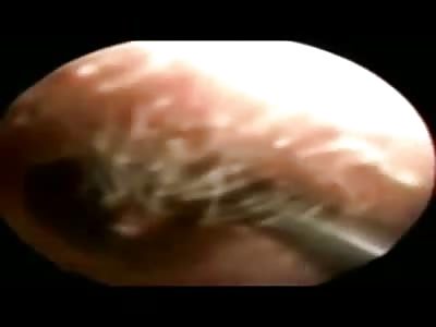 Doc I can't Hear.....Well, That's because Your Dirty ass Has a Cockroach Living in Your Ear