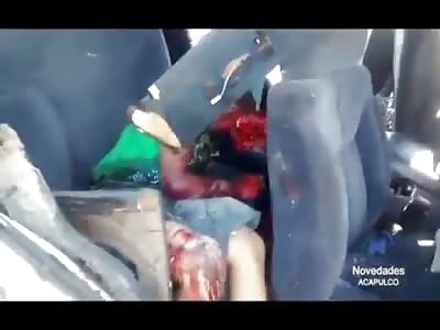 Boy's Jaw Ripped Off lies on the Road with his Father Dead in the Front