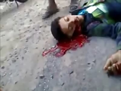 Kid Shot in the Face Poors Blood out his Nose like a Faucet  